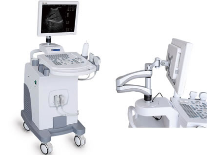 DW-370,全數字超聲診斷儀,推車式黑白B超機