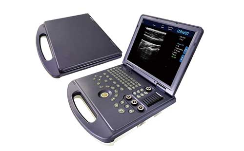 便攜式彩超機(jī)的優(yōu)勢分析